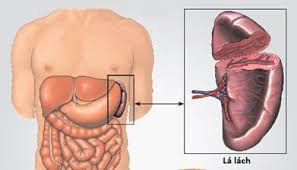 Chấn thương lách (vỡ lách) - Hình ảnh minh họa